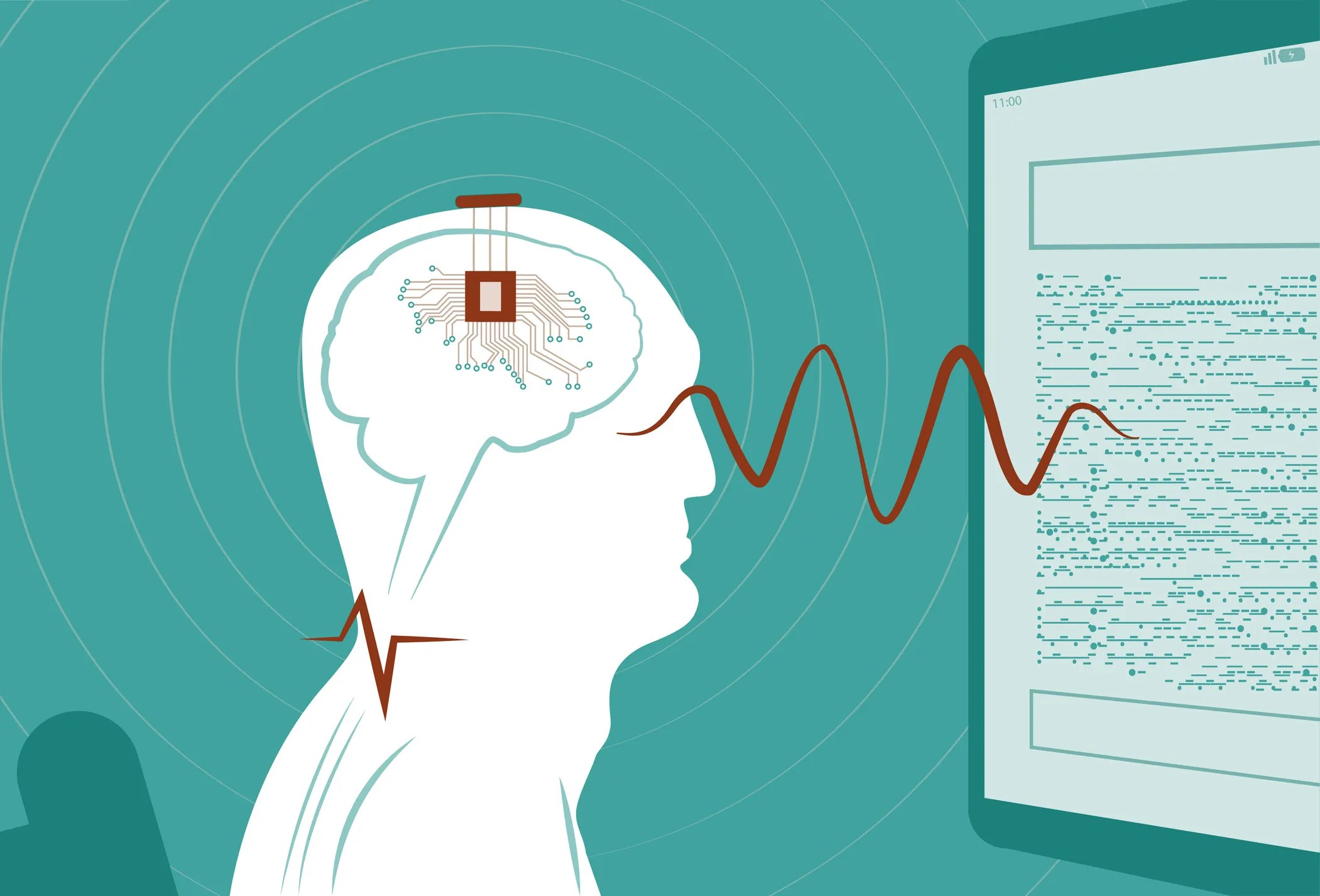 Brain connecting to machine through brain to computer interface (BCI) technology.