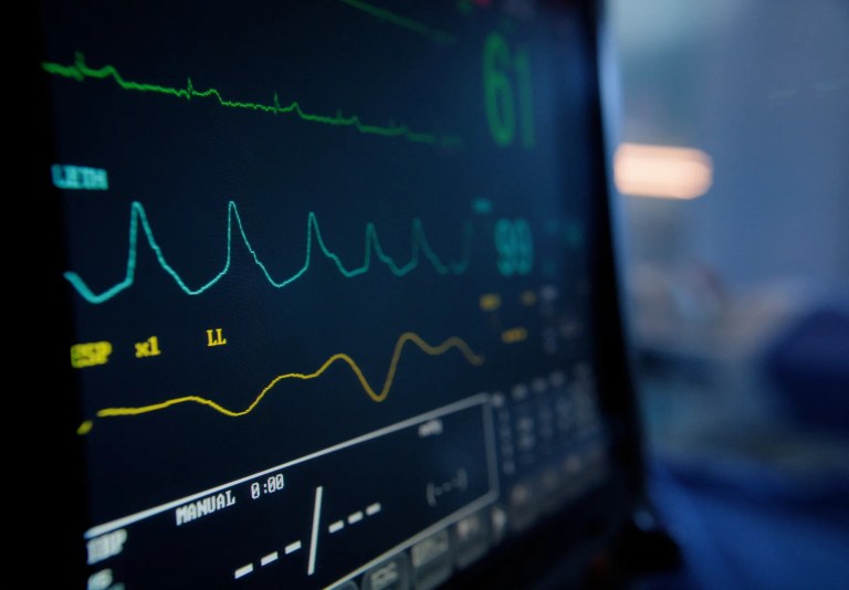 An IEC 60601-2-25 electrocardiograph (ECG or EKG) showing colorful lines of vital results