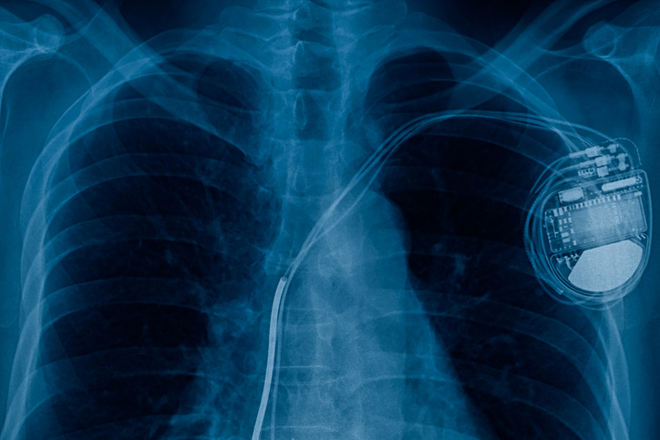 ISO 14117:2019 electromagnetic compatibility (EMC) test protocols active implantable medical devices Pacemaker
