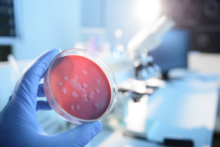 Microbiological culture in biosafety level 3 lab, BSL-3, designed with ANSI/ASSP Z9.14-2020