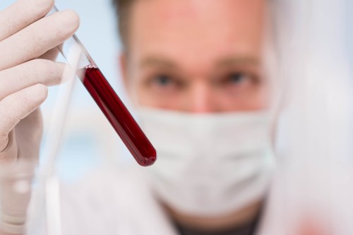 Doctor looking at a blood sample by following blood collection standards