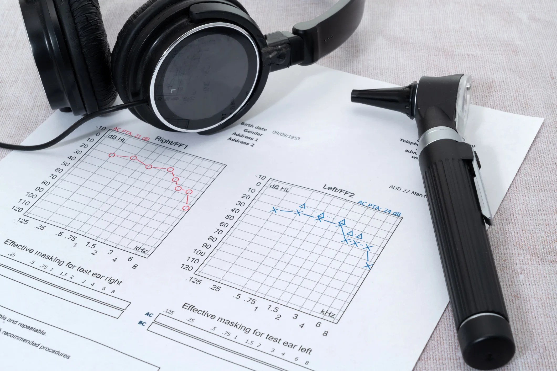 Speech audiology exam showcasing audiogram that adheres to ASA/ANSI S3.6-2025.