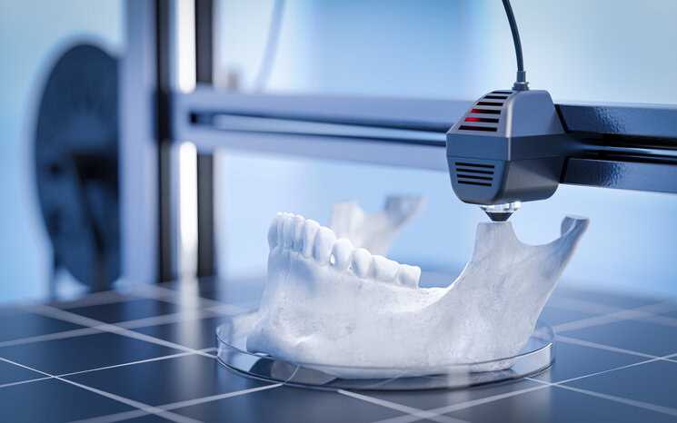 3d printing jaw