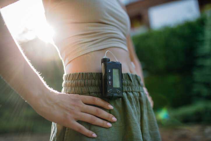 Close up of a diabetic woman outdoors with an insulin pump, adhering to ISO/IEEE 11073-10410:2019.