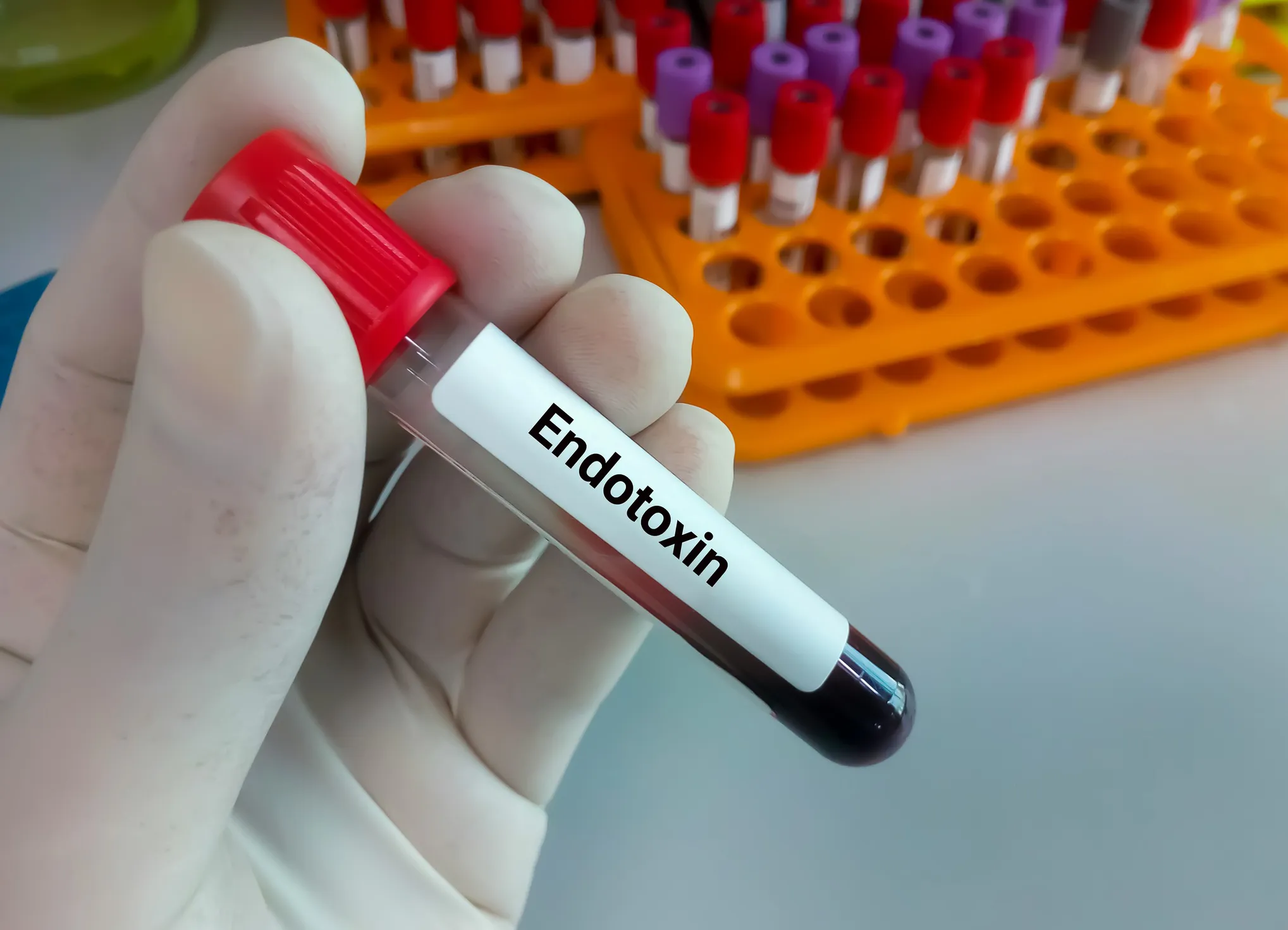 LAL test in a laboratory used by pharmaceutical and medical device manufacturers to test their medical products for the presence of endotoxins.