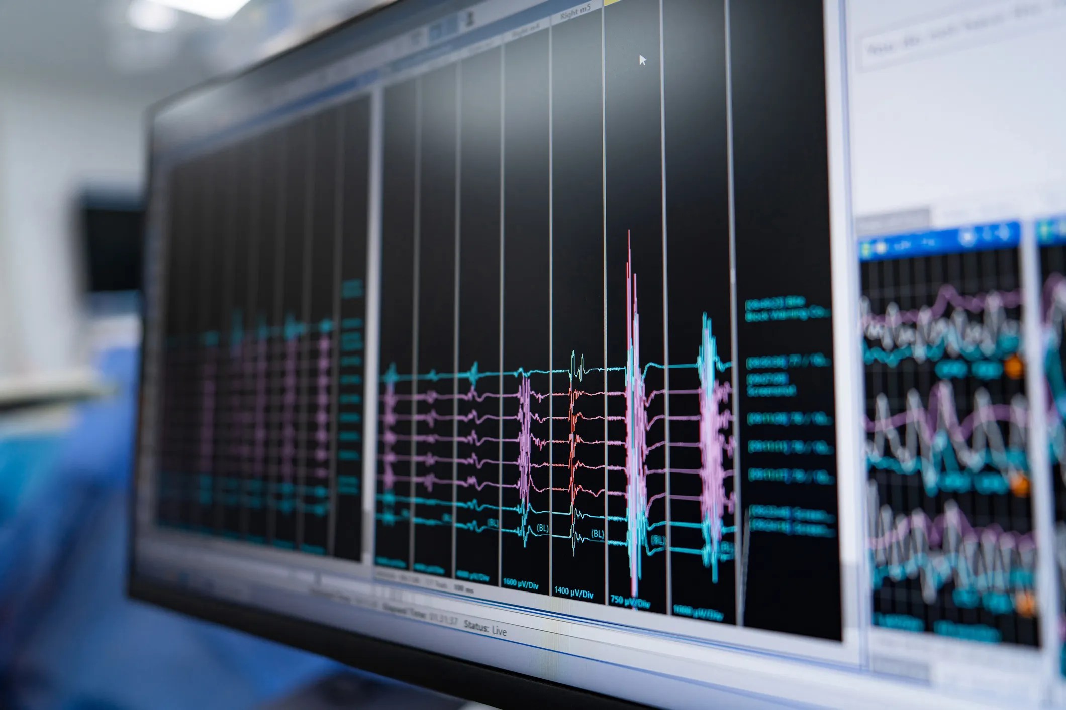 Engineers using acoustic measurement equipment to analyze sound pressure and vibration levels under standardized reference values as detailed in ASA/ANSI S1.8-2016 (R2025).
