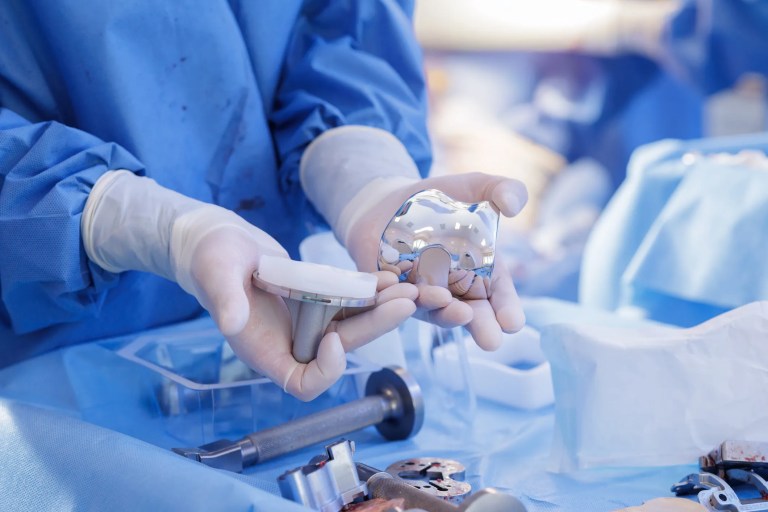 Medical implant (knee replacement) interacting with surrounding tissue, highlighting biocompatibility testing and local tissue response evaluation per ISO 10993-6:2026.