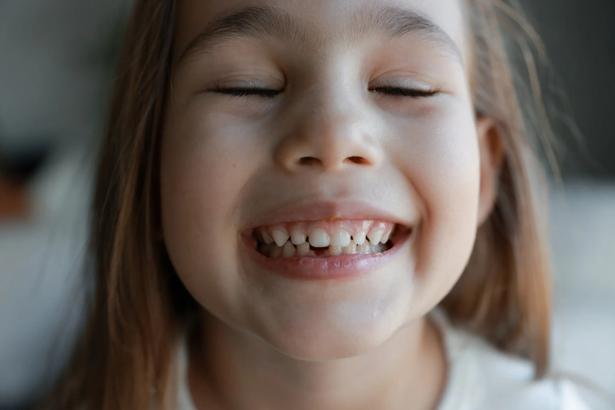 Little girl smiling with her baby teeth and adult teeth growing in, demonstrating the ANSI ADA 1119-2025 tooth developmental stage coding standard for dentistry and health data interoperability.