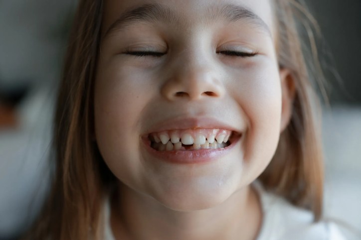Little girl smiling with her baby teeth and adult teeth growing in, demonstrating the ANSI ADA 1119-2025 tooth developmental stage coding standard for dentistry and health data interoperability.